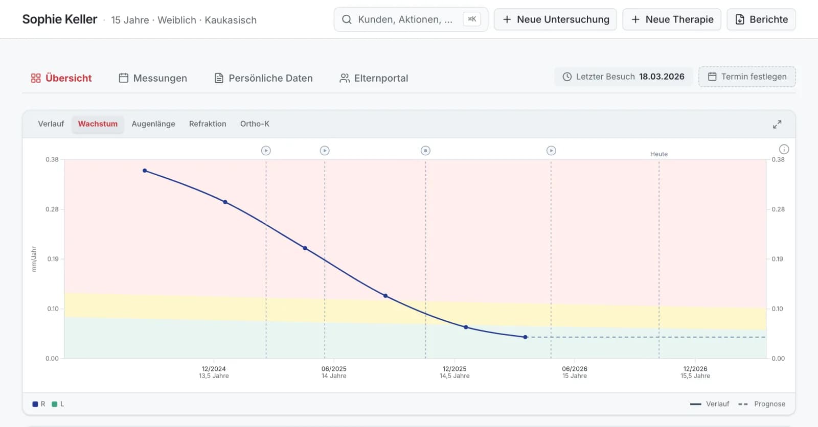Praxis-App, Reiter Wachstum: Das Wachstum der Augenlänge in mm pro Jahr sinkt nach Therapiebeginn in den grünen Bereich, mit Therapie-Markern und Prognose, Demo-Daten